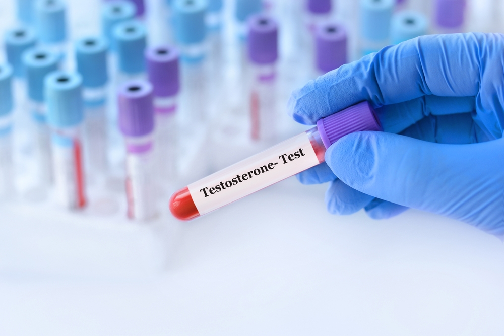 testosterone test tube.